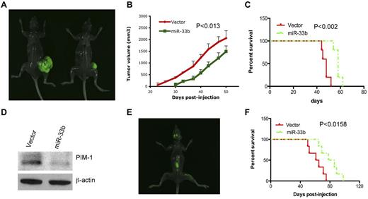Figure 6. Overexpression of miR33b inhibits tumor growth and prolongs survival in human plasmacytoma xenograft models. 5 × 106 or 2 × 106/100 μL of GFP-miR33b–transfected MM.1S cells or vector-transfected MM.1S cells were subcutaneously or intravenously injected into NOD.CB17-Prkdcscid/J mice (5 mice/group). Tumor volume was calculated using the following formula: V = 0.5a Xb2, where “a” and “b” are the long and short diameter of the tumor, respectively. Survival was evaluated from the first day of tumor injection until death. Representative photos of mice with tumor burden were taken with Imager Analyzer. (A) Representative image of mice with subcutaneous tumors. Left panel shows a mouse injected with vector-transfected MM.1S cells; the right panel shows a mouse injected with miR33b-transfected MM.1S cells. (B) Overexpression of miR33b inhibits tumor growth in a subcutaneous model. (C) Overexpression of miR33b prolongs survival in a subcutaneous model. (D) Mice tumors from the experiment described in panel A were analyzed for PIM-1 protein expression. (E) Representative image from mice receiving MM.1S miR33b-overexpressing cells in a disseminated MM model. Photo shows tumor homing in the backbone and skull region. (F) Overexpression of miR33b prolongs survival of mice in disseminated model. The log-rank test was used to evaluate the significance of survival of mice.
