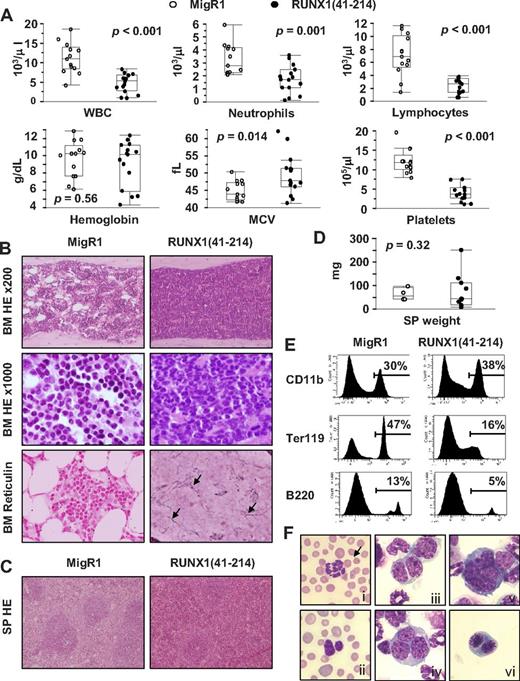 Figure 2. MDS and AML is observed in animals transplanted with RUNX1(41-214)–expressing cells. (A) Peripheral blood parameters of moribund animals transplanted with RUNX1(41-214)–expressing cells (●) at the time of death. Values of healthy MigR1 animals (○), killed at the same time, are shown as control. (B) Histopathologic analysis of BM of MigR1 and RUNX1(41-214) animals. HE staining of BM is shown at original magnification of ×200 and ×1000. Reticulin staining of BM is shown at original magnification of ×200. Arrows point to reticulin fibers stained in black. (C) Histopathologic analysis of SP of MigR1 and RUNX1(41-214) animals. HE staining of SP is shown at original magnification of ×100. (D) SP weight of MigR1 (○) and RUNX1(41-214) animals (●) at the time of death. (E) Representative flow cytometric analysis of total BM of animals that received a transplant with MigR1 and RUNX1(41-214). (F) Cytologic analysis (Wright-Giemsa staining) of RUNX1(41-214) animals: (Fi) hypersegmented neutrophil in peripheral blood; arrow points to Howell-Jolly body in red blood cell; (Fii) Perger-Huët anomaly in peripheral blood, also note polychromasia and anisocytosis in red blood cells; (Fiii) binucleated neutrophilic metamyelocyte; (Fiv) trinucleated neutrophilic metamyelocyte; (Fv) micromegakaryocyte; (Fvi) binucleated prorubricyte (original magnification, ×1000). WBC indicates white blood cells; MCV, mean corpuscular volume; HE, hematoxylin-eosin; and SP, spleen. All images were acquired with BX51 microscope with objective lenses 10× PlanFLN/0.3, 20× PlanFLN/1.42, 100× PlanFLN/1.3, equipped with DP71 digital camera (Olympus).