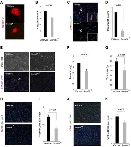 Figure 7. Choroidal, Matrigel-supported and tumor neovascularization in Sema6A−/− and wild-type mice. (A) Choroidal neovascularization was evaluated on day 7 after laser injury to the Bruch membrane; representative images of injured areas in representative wild-type and Sema6A-null littermates (6 weeks old); isolectinB4 staining. (B) Quantitative analysis of choroidal neovascularization 7 days after laser injury to the Bruch membrane in groups of wild-type and Sema6A-mutant mice (5 to 6 weeks old). The area occupied by vessels was measured after staining eye wholemount with isolectin B4; the results reflect the group means (n = 8; mean ± SEM; p reflects the statistical significance of group difference). (C) Matrigel plugs containing VEFGA (150 ng/mL), FGF2 (150 ng/mL), and heparin (0.5 mg/mL) were produced subcutaneously in wild-type and in Sema6A−/− mice (5 weeks old); plugs were removed after 7 days, processed for histology, and stained for CD31 and NG2. Representative images: the arrow points to a vessel within the matrigel plug, magnified in the inset. (D) Quantative analysis of matrigel neovascularization in groups of wild-type and in Sema6A−/− mice (5 to 6 weeks old; 5/group) based on CD31 positive area. (E) Sema6A immunostaining of representative Matrigel plugs from wild-type and Sema6A−/− mice. Nuclei are detected with DAPI. Corresponding bright field images are shown in the top panels. (F) B16 murine melanoma and (G) LLC/1 Lewis lung murine carcinoma cells (10 × 106) were injected subcutaneously in groups of wild-type and Sema6A−/− mice. The tumors were removed after 10 days (B16) or 12 days (LLC/1) and weighed. The bar graphs represent the mean (n = 14/group; +/− SEM) tumor weight/group. CD31 and NG2 immunostaining in B16 (H-I) and LLC/1 (J-K) tumor tissues. Representative images of immunostaining are shown in (H) and (J). The bar graphs in (I) and (K) represent the mean CD31 staining (area of CD31 staining/unit area of tumor; n = 14/group; +/− SEM). The P values reflect the statistical significance of group differences.