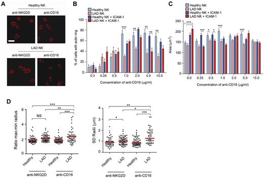 Figure 4. The CD16-mediated symmetric spreading is LFA-1– and kindlin-3–dependent. (A) Fluorescence images of F-actin in healthy donor NK cells or LAD-III NK cells stimulated on surfaces coated with anti-NKG2D (3.0 μg/mL) or anti-CD16 (5.0 μg/mL). (B) The percentage of healthy or LAD-III NK cells forming a peripheral ring of F-actin in response to surfaces coated with poly lysine and indicated concentrations of anti-CD16 (light blue and pink, respectively) or surfaces coated with ICAM-1 and indicated concentrations of anti-CD16 (blue and red, respectively). Graphs represent mean ± SEM; n = 60-90. (C) The area of cells attached to the slide surface, as assessed by IRM imaging, was measured for healthy and LAD-III NK cells on surfaces coated with ICAM-1 and increasing concentrations of anti-CD16 (blue and red, respectively) and for healthy and LAD-III NK cells on surfaces coated with poly lysine and increasing concentrations of anti-CD16 (light blue and pink, respectively). Graphs represent mean ± SEM; n = 60-90. (D) The distance from the centroid of healthy or LAD-III NK cells (cell activated using anti-CD16 and anti-NKG2D at 5.0 μg/mL) stained with phalloidin-ATTO-647N to the circumference was measured at 360 radii, and the symmetry of the cells was assessed by the SD of the radii (left) and the ratio of maximum and minimum lengths (right, n = 40-70). ***P < .0005 (ANOVA). **P < .005 (ANOVA). *P < .05 (ANOVA). NS indicates not significant.