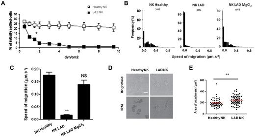 Figure 5. Spreading of LAD-III NK cells on ICAM-1 is intact, whereas shear-resistant adhesion and migration are impaired. (A) The figure shows the LFA-1–dependent adhesion under shear force. NK cells derived either from a healthy control (□) or from the LAD-III patient (■) were settled for 1 minute on ICAM-1-Fc–coated surfaces (350 sites/μm2) and were then subjected to increasing shear forces. Figure shows 1 representative experiment of 3 performed. Data are mean ± SD. Error bars (SD) are derived from triplicates. *P < .05. (B) Frequency histograms of the speed of cell migration on ICAM-1–coated slides measured at 5-second intervals, from healthy control NK cells or from the LAD-III patient NK cells, which had either been stimulated with 5mM MgCl2 or left untreated. The total number of time points analyzed for each experimental condition is indicated. (C) The average migration speeds of healthy control NK cells, LAD-III patient NK cells, or Mg2+ stimulated LAD-III patient NK cells on ICAM-1. Data are mean ± SEM, derived from 3 separate experiments. **P < .005. NS indicates not significant. (D) Bright-field and IRM images of NK cell surface attachment and spreading on ICAM-1 from a healthy control (left) or from the LAD-III patient (right). Scale bar represents 10 μm. (E) Quantification of the area of surface attachment for n > 60 cells. Data are mean ± SEM. **P < .005.