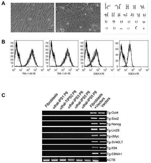Figure 1. Reprogramming of α-thalassemia fibroblasts and characterization of iPSCs. (A) Phase contrast micrographs illustrating the morphology of fibroblasts (left panel) and iPSCs (middle panel). iPSCs had normal karyotype in culture (right panel). (B) FACS analysis showing that iPSCs express TRA-1-60, TRA-1-80, SSEA-4, and SSEA-3, 4 typical hESCs and iPSCs surface markers. (C) PCR analysis showing loss of the episomal vectors used to reprogram patient-specific fibroblasts after 8 passages in culture. ACTB are control primers that detect a small genomic DNA fragment of the β-actin gene.