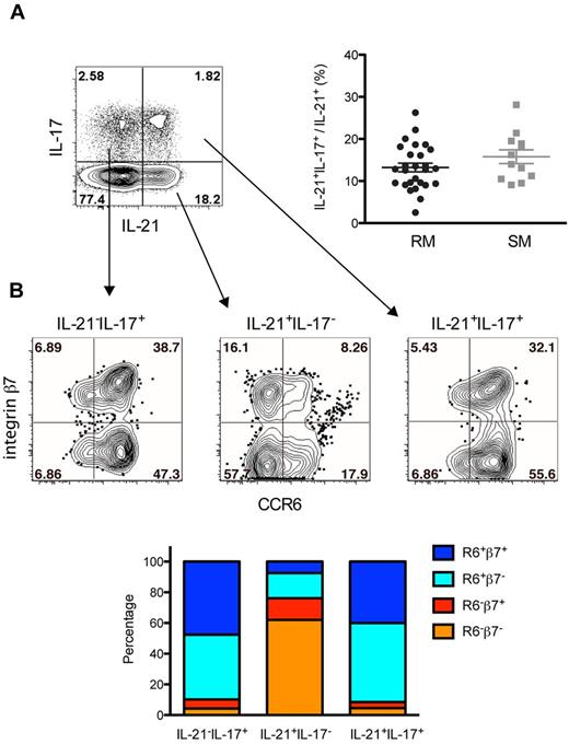 Figure 1. Phenotype of IL-21–producing cells in SIV-uninfected nonhuman primates. Characterization of IL-21–producing cells in the PB of SIV-uninfected RMs and SMs. (A) The large majority of CD4+IL-21+ T cells are not Th17 cells. Dot plot shows IL-21 by IL-17 staining in CD4+ T cells from a representative RM. The graph shows the fractions of total CD4+IL-21+ that are IL-17+ in PB of all RMs and SMs. (B) Fraction of IL-21−IL-17+, IL-21+IL-17−, or IL-21+IL-17+ CD4+ T cells expressing the chemokine receptors CCR6 and α4β7. Dot plots show CCR6 by integrin β7 staining in the 3 populations from a representative RM. The graph shows the percentages of IL-21−IL-17+, IL-21+IL-17−, or IL-21+IL-17+ CD4+ T cells expressing CCR6 and/or β7 in all RMs.