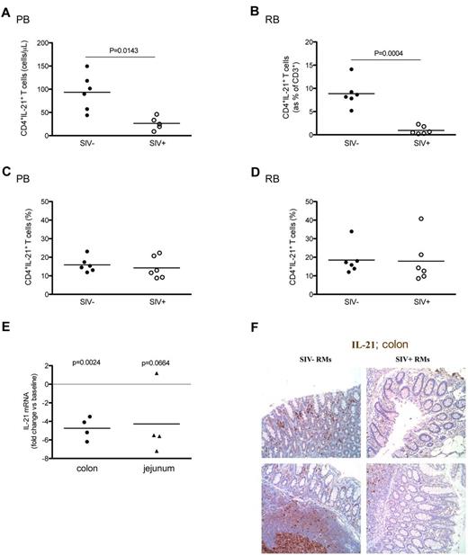Figure 4. Levels of blood and intestinal CD4+IL-21+ T cells in chronic intravenous SIV infection of RMs. The absolute values (A-B) and percentages (C-D) of circulating (A,C) and intestinal (B,D) CD4+IL-21+ T cells were compared between intravenously SIV-infected (○) and uninfected (●) RMs. (D) In RBs, the absolute values of IL-21–producing CD4+ T cells are expressed as fraction of total CD3+ T cells. (E) Levels of IL-21 mRNA in the colon and jejunum of 4 RMs before (baseline) and at 10-12 weeks after SIV infection. IL-21 mRNA values are expressed relative to the values for GAPDH, and the ratios obtained with the baseline values were used to calculate the fold increases. (F) IL-21 protein levels were assessed in the colon by immunohistochemistry. IL-21+ cells within the lamina propria (top panel) as well as follicular aggregates (bottom panel) are shown in 2 (of 3) representative SIV-uninfected and 2 (of 5) representative SIV-infected RMs. Statistical analyses were performed to compare the levels of CD4+IL-21+ T cells (A-D) and of IL-21 mRNA (E) between SIV-infected and uninfected animals.