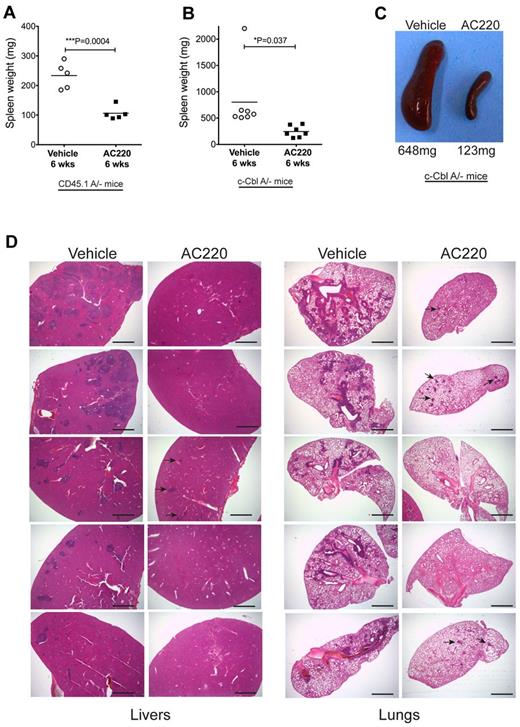Figure 3. AC220 treatment of c-Cbl RING finger mutant mice results in a significant reduction of splenomegaly and the loss of invasive myeloid-lineage cells from the liver and lungs. Spleen weights were determined after 6 weeks of daily dosing with vehicle or AC220 of C57BL/6.CD45.1 mice repopulated with BM cells from an 8-week-old c-CblA/− mouse (A) and 8- to 9-month-old naturally bred c-CblA/− mice (B). (C) Photograph of spleens from a vehicle- and an AC220-treated c-CblA/− mouse after 6 weeks of dosing. (D) H&E-stained sections of livers and lungs from c-CblA/− mice 8-9 months of age that were dosed daily for 6 weeks with vehicle or AC220. The AC220-treated mice showed a marked reduction in myeloid cell invasion, with residual regions of infiltrating cells in AC220-treated mice indicated by arrows. The images were acquired at room temperature using an Olympus BX51 microscope with a 2×/0.08 objective and photographed with an SIS 3VCU Olympus digital camera. Scale bar indicates 2 mm.