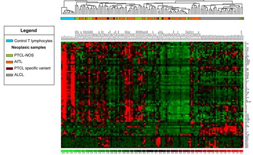 Figure 2. snoRNA expression–based unsupervised hierarchical clustering of PTCL and normal T cells. High-throughput quantitative PCR was carried out on 80 snoRNAs in 90 non-ALCL and 32 ALCL patients. Each column represents a case and each row the expression level of a gene. Gene-expression levels are depicted according to the color scale shown. Correlation analysis and the centroid method were applied.