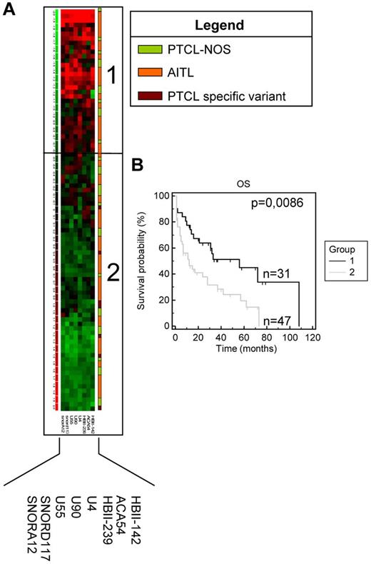 Figure 4. OS analysis based on differential expression of 8 snoRNAs in non-ALCL PTCL patients. (A) Heat map showing snoRNA expression in non-ALCL PTCL patients. Each column represents the expression level of a gene and each row a patient (diagnosis of each patient is depicted according to the color legend shown). Gene-expression levels are depicted according to the color scale shown. (B) OS comparison for patients overexpressing these snoRNAs (group 1) and other patients (group 2).