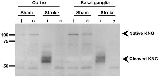 Figure 1. The kallikrein-kinin system is activated in the ischemic mouse brain after stroke as indicated by KNG consumption. Immunoblot from the cortex and basal ganglia of a mouse subjected to tMCAO with the use of an antibody against KNG. The 24 hours after stroke time point is depicted. A sham-operated mouse served as control. Immunoreactivity against native KNG was markedly down-regulated in the brain of the mouse with cerebral ischemia. In contrast, cleaved KNG, which is produced when native KNG is consumed by plasma kallikrein to form bradykinin, was up-regulated in the ipsilateral (i), that is, ischemic cortex and basal ganglia of the mouse with stroke but not in corresponding regions of the brain of the sham-operated mouse or the healthy contralateral (c) hemisphere. Immunoblots were independently replicated from 3 different animals. One representative sample is shown.