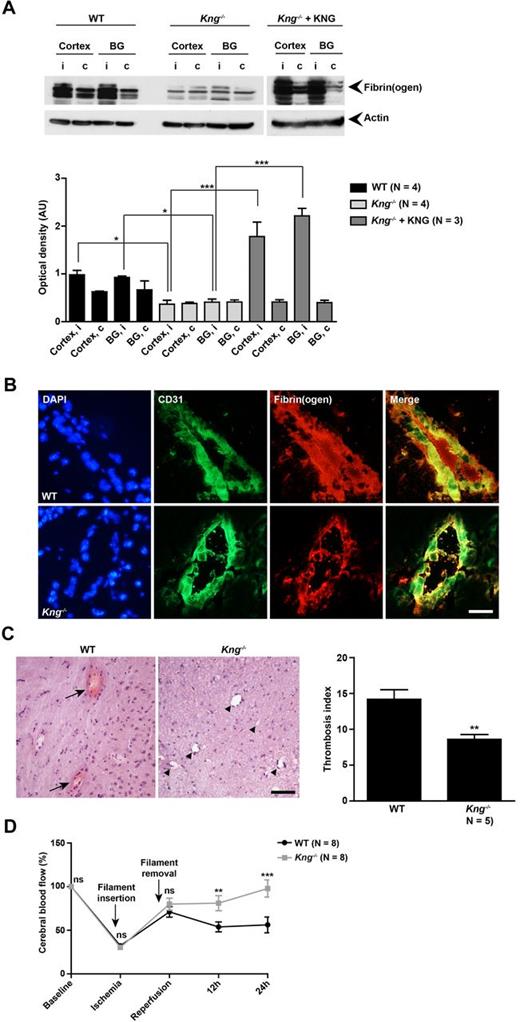 Figure 3. KNG deficiency reduces intracerebral thrombosis and improves cerebral blood flow after stroke. (A) Accumulation of fibrin(ogen) in the infarcted (i) and contralateral (c) cortices and basal ganglia (BG) of wild-type (WT) mice, Kng−/−mice and Kng−/− mice reconstituted with human kininogen (KNG) was analyzed by immunoblotting 24 hours after tMCAO (top), and bands were quantified by densitometry (bottom; N = 3-4 per group). One representative immunoblot of each group is shown. AU indicates arbitrary units. (B) Immunohistochemical localization of fibrin(ogen) in the lumina of brain microvessels (stained with the endothelial marker CD31) 24 hours after tMCAO in the infarcted hemispheres of WT mice or Kng−/− mice. Hoechst staining (blue) depicts cell nuclei. One representative panel per group of 3 independent experiments is shown. Scale bar represents 50 μm. (C left) Representative H&E staining from the infarcted hemispheres of WT mice and Kng−/− mice on day 1 after tMCAO. Thrombotic vessels were abundant in WT mice (arrows), whereas the microvascular patency was significantly increased in Kng−/− mice (arrowheads), and this was confirmed by calculation of the thrombosis index (right; N = 5 per group). Scale bar represents 100 μm. (D) Reduced intracerebral thrombosis in Kng−/− mice improved CBF in the territory of the right middle cerebral artery 12 and 24 hours after reperfusion compared with WT mice as determined by serial laser Doppler flow measurements. No differences in CBF were detectable at baseline (before ischemia), immediately after insertion of the filament (ischemia), or immediately after reperfusion (removal of the filament; N = 8 per group and time point). (A) ***P < .001, *P < .05, 2-way ANOVA, followed by Bonferroni multiple comparison test, group comparisons as indicated in the figure. (C) **P = .005, unpaired Student t test. (D) ***P < .001, **P < .01, 2-way ANOVA, followed by Bonferroni multiple comparison test compared with WT mice.