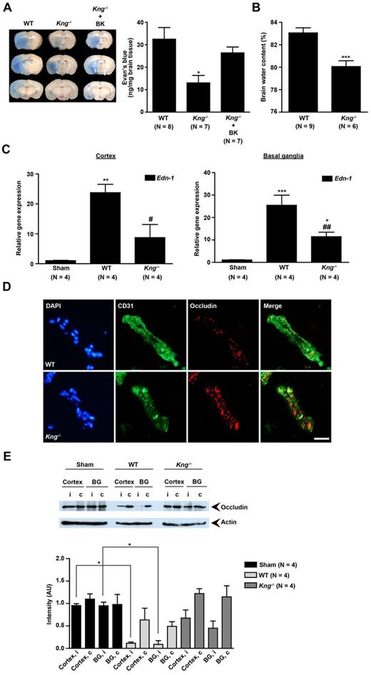 Figure 5. KNG deficiency has profound blood-brain barrier stabilizing and antiedematous effects in ischemic stroke. (A left) Representative corresponding coronal brain sections from a wild-type (WT) mouse, a Kng−/− mouse, and a Kng−/− mouse reconstituted with bradykinin (BK) on day 1 after tMCAO after injection of the vascular tracer Evans blue. Vascular leakage was significantly decreased in the absence of KNG after stroke as confirmed by the concentration of Evans blue detectable in the brain parenchyma (right). BK reconstitution restored edema formation in Kng−/− mice (N = 7-8 per group). (B) Edema formation as reflected by the brain water content in the ischemic hemispheres of WT mice and Kng−/− mice on day 1 after tMCAO (N = 6-9 per group). (C) Relative gene expression of endothelin-1 (Edn-1) in the cortices and basal ganglia of WT mice and Kng−/− mice 24 hours after tMCAO or sham operation (N = 4 per group). (D) Expression of occludin on day 1 after tMCAO in the hemispheres of WT mice and Kng−/− mice. Immunohistochemistry suggests that occludin is predominately located in the gaps between vascular endothelial cells (indicated by the marker CD31). Occludin expression was markedly reduced in WT mice but preserved in mice lacking KNG. Hoechst staining (blue) depicts cell nuclei. One representative panel per group of 3 independent experiments is shown. Scale bar represents 50 μm. (E top) Occludin expression in the cortex or basal ganglia (BG) of WT mice or Kng−/− mice on day 1 after tMCAO or sham operation as determined by immunoblot. One representative immunoblot of each group is shown. (Bottom) Densitometric quantification of occludin immunoreactivity in the mouse groups indicated above (N = 4 per group). The i indicates ipsilateral (ischemic) hemisphere; c, contralateral (healthy) hemisphere. (A,B) ***P < .001, *P = .0148, unpaired Student t test. (C) ***P < .001, **P < .01, *P < .05, ##P < .01, #P < .05, 1-way ANOVA followed by Bonferroni multiple comparison test compared with sham-operated mice (* symbol) or WT (# symbol) mice. (E) *P < .05, 2-way ANOVA, followed by Bonferroni multiple comparison test, group comparisons as indicated in the figure.