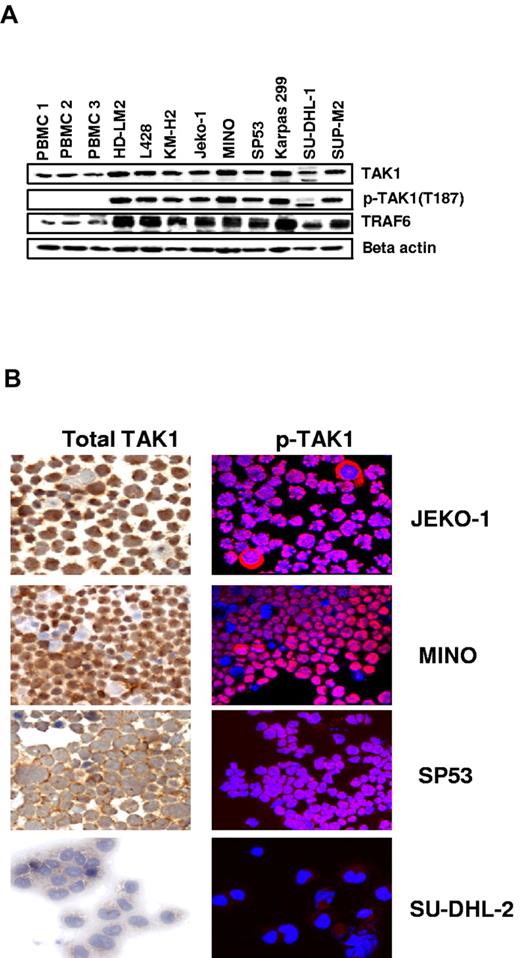 Figure 1. Expression of TAK1 in lymphoma cell lines. (A) Lymphoma cell lines have greater expression of TAK1 and pTAK1 compared with PBMCs from healthy donors. TRAF6, which is frequently required for TAK1 activation, and β-actin were used as controls. (B) Immunohistochemical analysis of TAK1 and pTAK1 expression in the cytospins of MCL lines demonstrating a cytoplasmic distribution pattern for pTAK1.