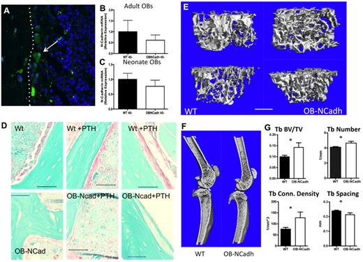 Figure 1. Lack of osteoblastic N-cadherin results in increased bony trabecular structures. (A) Representative image of a frozen section from a Col1-cre, Z/EG mouse. eGFP resulting from Cre recombination is green and highlighted by the arrow. The white dotted line indicates the endosteal surface with bone to the left and marrow to the right. (B-C) Quantitative RT-PCR analysis of N-cadherin mRNA expression. (B) Cells isolated from adult long bones. (C) Cells isolated from neonate calvaria. (D) Representative images of paraffin sections from WT (top panels) or OB-NCadh mice (bottom panels) that are untreated (left panels) or treated with PTH (middle and right panels) immunohistochemically stained for N-cadherin in which N-cadherin+ cells are pink. Images obtained using a 60× objective. (E) Representative micro-CT scans of trabecular bone at the metaphysis of the femur (top) or tibia (bottom). (F) Representative micro-CT scans of the femur and tibia. (G) Analysis of micro-CT scans showing trabecular BV/TV, trabecular number, trabecular connectivity density, and trabecular spacing. *P < .05. n = 6 to 12 male mice per group.