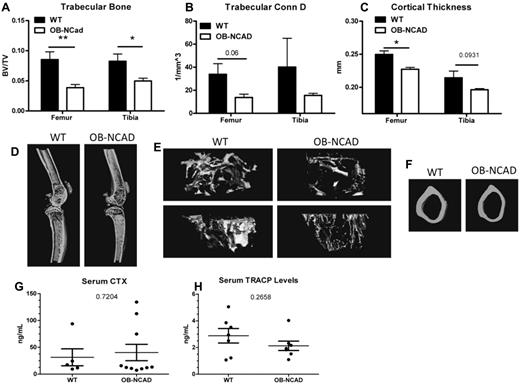 Figure 4. Lack of osteoblastic N-cadherin results in decreased mineralized trabecular BV/TV and cortical thickness at 1 year of age. (A-C) Quantitative analysis of micro-CT scans depicting trabecular BV/TV (A), trabecular connectivity density (B), and cortical thickness (C). *P < .05. **P < .01. n = 3 or 4 male mice per group. (D) Representative micro-CT scans of the distal femur (top), knee joint and proximal tibia (bottom), of WT (left) and OB-NCadh (right) mice. (E) Representative micro-CT scans of trabecular bone at the metaphysis of the femur (top) or tibia (bottom) of WT (left) and OB-NCadh (right) mice. (F) Representative micro-CT scans of femur cortical bone from WT (left) and OB-NCadh (right) mice. (G-H) Quantitation of serum CTX (G) and tartrate-resistant acid phosphatase (H) levels in 1-year-old mice. Each dot represents an individual mouse; data are mean ± SEM.