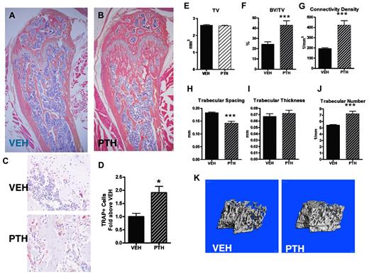Figure 6. PTH treatment (3 times a day) increases trabecular bone volume and osteoclastic cells. (A-B) Representative images of H&E-stained paraffin sections from the distal femur of (A) VEH-treated and (B) PTH-treated mice. Images were obtained using a 4× objective. (C) Representative images of TRAP-stained paraffin sections from VEH-treated (top panel) and PTH-treated (bottom panel) mice. Sections were counterstained with hematoxylin. Images were obtained using a 20× objective. (D) Quantification of TRAP+ cells from paraffin sections represented by panel C. (E-J) Micro-CT analysis of trabecular bone from the femur of VEH- and PTH-treated mice, including (E) total volume, (F) bone volume/total volume, (G) connectivity density, (H) trabecular spacing, (I) trabecular thickness, and (J) trabecular number. (K) Representative micro-CT images of trabecular bone from the femur of VEH- or PTH-treated mice. *P < .05. **P < .01. ***P < .001. n = 5 or 6 per treatment group.