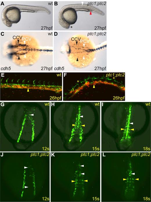 Figure 1. Zebrafish ptc1;ptc2 double mutants fail to establish circulation and exhibit multiple endothelial defects and defective angioblast migration. (A-B) ptc1;ptc2 mutant (B) embryos at 27 hpf showed somitic flattening (white arrowhead) and loss of lens (asterisk). ptc1;ptc2 embryos showed noncirculating primitive erythrocytes in the posterior intermediate cell mass (red arrowhead). (C-D) cdh5 expression in ptc1;ptc2 mutants (D) revealed defective formation of the common cardinal vein (CCV; black arrowheads) and PCV (white arrowheads) compared with wild-type (C). (E-F) Confocal image of trunk vasculature in Tg(fli1a:EGFP)y1;Tg(gata1:dsred)sd2/+ (E) and Tg(gata1:dsred)sd2/+;ptc1;ptc2 (F) embryos; anterior to the left, posterior right. The primary vasculature formed normally in Tg(fli1a:EGFP)y1;Tg(gata1:dsred)sd2/+ embryos, and circulation commenced normally (yellow arrowhead; supplemental Video 1), whereas Tg(fli1a:EGFP)y1;Tg(gata1:dsred)sd2/+;ptc1;ptc2 embryos had disorganized vasculature, axial vessels were noncontinuous along their anteroposterior axis (asterisks), and embryos lacked circulation (yellow arrowhead; supplemental Video 2). (G-L) Confocal images using a Tg(fli1a:EGFP)y1/+ background to visualize migrating angioblasts in indicated genetic backgrounds. Dorsal views are shown. (G-I) Normal angioblast migration in Tg(fli1a:EGFP)y1/+ embryos. (J-L) Fewer angioblasts migrated to the midline in Tg(fli1a:EGFP)y1/+;ptc1;ptc2 embryos and formed a discontinuous endothelial cord by 18 somites (supplemental Video 3; white arrowheads). Angioblasts were present in more lateral positions (supplemental Video 4; L yellow arrowheads) than in controls at the corresponding stage (I yellow arrowheads).