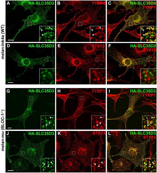 Figure 7. SLC35D3 accumulates in melanosomes upon ectopic expression in wild-type but not muted (BLOC-1–deficient) melanocytes. Immortalized wild-type melan-Ink4a melanocytes (A-F) or BLOC-1–deficient melan-mu melanocytes (derived from muted mice; G-L) were infected with HA-SLC35D3 retrovirus, and then analyzed by IFM with Abs to the HA epitope (green; panels A, D, G, and J) and either the melanosome-resident protein TYRP1 (red; panels B and H) or the early endosomal SNARE protein STX13 (red; panels E and K) and appropriate secondary Abs. Images were deconvolved using OpenLab (A-C) or Volocity (D-L). Overlays of the 2 labels are shown in panels C, F, I, and L, and the boxed regions are magnified 5-fold (A-F) or 4-fold (G-L) in the insets. Note the extensive overlap of HA-SLC35D3 with TYRP1 on pigment granules (A-C) but not with STX13 (D-F) in wild-type melanocytes. In BLOC-1–deficient melan-mu cells, SLC35D3 also overlaps extensively with the mislocalized TYRP1 (G-I) on early endosomes marked by STX13 (J-L). Arrowheads in insets show examples of overlap. Scale bar indicates 10 μm.