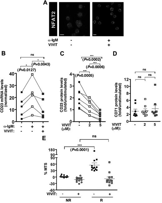 Figure 5. VIVIT peptide inhibitor blocks the BCR/NFAT-dependent pathway in responding CLL B cells. (A) NFAT2 immunofluorescence staining of CLL B cells from 1 representative R case (n = 3) stimulated or not in the presence or not of NFAT inhibitor 11-R VIVIT (5μM for 24 hours). Scale bar corresponds to 5 μm. (B) Quantitative RT-PCR analysis of CD23 transcript expression levels in freshly isolated B cells from R cases (n = 5) on stimulation with anti-IgM (10 μg/mL) in the presence or not of 11-R VIVIT (5μM). CD23 mRNA expression was normalized on ABL transcript expression in each tested sample, and results were graphed. Cell surface expression of CD23 protein (C) or CD71 protein (D) was determined using flow cytometry analysis on CLL cells from 7 (C) or 8 (D) R cases stimulated with anti-IgM (10 μg/mL) in presence of increasing concentrations (0, 2, and 5μM) of 11-R VIVIT. Levels are indicated as fold increase on stimulation. (E) Fold increase of metabolic activity (% MTS) was determined on 48-hour BCR stimulation for 13 NR and 12 R cases. B lymphocytes were incubated in the presence or not of 11-R VIVIT (5μM).