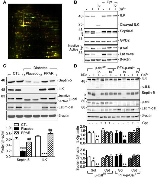 Figure 1. Characterization of new calpain substrates in human and murine platelets. (A) Representative differential in-gel electrophoresis of platelet proteins from the same diabetic patient treated with placebo or pioglitazone (red spots indicate proteins down-regulated by pioglitazone; green spots, proteins that were up-regulated). (B) Representative blots showing the effect of Ca2+ (5mM) and ionomycin (Io; 1μM)–induced μ- and m-calpain activation on the levels of septin-5, ILK, and GPD2 in washed human platelets. (C) Levels of septin-5 and ILK in washed platelets from healthy donors (CTL) and patients with type 2 diabetes treated with placebo or pioglitazone (PPAR) (data shown from same patients). (D) Effect of μ- and m-calpain activation on septin-5 and ILK in platelets from μ-calfl/lfl and PF4-μ-cal−/− mice. Experiments were performed in the absence or in the presence of calpeptin (Cpt, 10μM). Arrow indicates the product after μ-calpain activation; arrowhead, product after m-calpain activation. Blots are representative of 5-6 additional experiments and graphs summarize data obtained in 8 subjects/animals per group. *P < .05; **P < .001; ***P < .001 versus healthy donors or untreated platelets; ###P < .001 versus placebo.