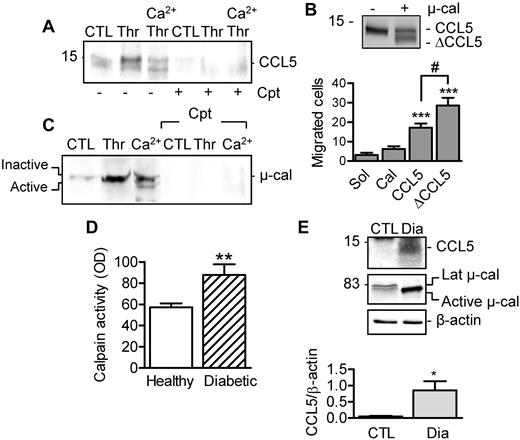 Figure 3. Effect of calpain-mediated cleavage on CCL5 activity. (A) CCL5 release and cleavage after calpain activation in the absence and presence of calpeptin (Cpt, 10μM). (B) Cleavage of recombinant CCL5 by μ-calpain and chemotactic activity of full-length and calpain-cleaved CCL5 (ΔCCL5) on THP-1 cells in a Transwell chamber. (C) μ-calpain in releasates from resting platelets or platelets activated with thrombin alone or after stimulation with Ca2+ (5mM, 30 minutes) in the absence or in the presence of calpeptin (Cpt). (D) Calpain activity in plasma from healthy subjects and from patients with type 2 diabetes. (E) CCL5 and μ-calpain in circulating microparticles isolated from healthy subjects (CTL) and patients with type 2 diabetes (Dia). The graphs summarize data obtained with 5-6 subjects per group. *P < .05; **P < .01; ***P < .001 versus CTL/Sol; #P < .05 versus full-length CCL5.