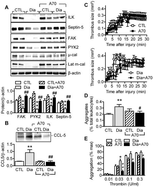 Figure 6. Reversal of the diabetes-associated calpain overactivation by in vivo calpain inhibition. (A) ILK, septin-5, FAK, and PYK2 levels in platelets from healthy (CTL) and streptozotocin-induced diabetic mice (Dia) treated with vehicle or the calpain inhibitor A-705253 (A70). (B) CCL5 in microparticles isolated from the plasma of healthy (CTL) or diabetic (Dia) mice treated with vehicle or A-705253. (C) Effect of in vivo A-705253 treatment on thrombus size after FeCl3-induced injury of carotid arteries from healthy (top panel) and diabetic (bottom panel) mice. (D) Number of circulating platelet-leukocyte aggregates in healthy (CTL) and diabetic (Dia) mice treated with vehicle or A-705253. (E) Aggregation of platelets from healthy and diabetic mice treated with vehicle or A-705253. The graphs summarize data obtained in platelets from 6-9 animals per group. *P < .05; **P < .01 versus CTL; #P < .05; ##P < .01 versus vehicle-treated diabetic mice.