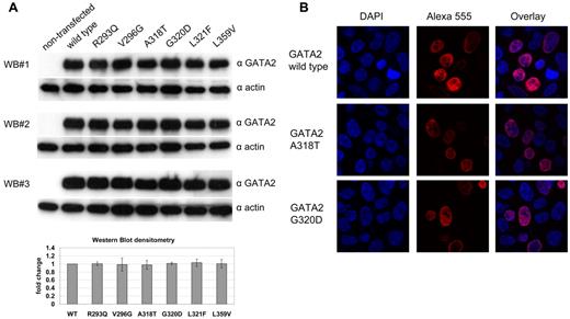 Figure 2. Expression of GATA2-mutants in HEK 293T cells. (A) Expression of FLAG-tagged GATA2-mutants confirmed by 3 independent Western blot (WB) experiments using anti-GATA2 antibodies (top) and anti–β-actin antibodies (bottom). Graph shows mean values of the GATA2 signals normalized to β-actin signals as fold change compared with wild-type GATA2. Error bars indicate standard error of the mean. (B) Immunofluorescence of GATA2 using anti-FLAG antibodies and Alexa 555–labeled secondary antibodies. DNA was counter stained using 4,6-diamidino-2-phenylindole. Confocal laser scans show nuclear localization for GATA2 wild type (top) and the recurring GATA2-mutants A318T (middle) or G320D (bottom). Similar results were obtained for all GATA2-mutants tested (see supplemental Figure 3).
