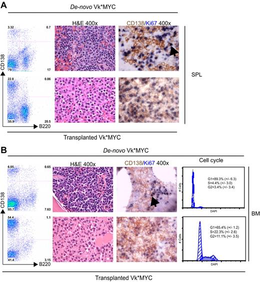 Figure 2. Comparison of de novo with transplanted Vk*MYC mice. (Left panel) A flow cytometric analysis of SPL (A) and BM (B) from a matching de novo Vk*MYC and transplant recipient mouse highlighting higher tumor burden and extramedullary MM in tVk*MYC mice. (Middle panel) Immunostaining of (A) SPL and (B) BM sections from de novo and tVk*MYC mice identify a high fraction of proliferating (Ki67+, blue) MM (CD138+, brown) cells in tVk*MYC mice only. Arrows highlight the rare double-positive cells in the de novo Vk*MYC mice. (B left panel) Cell-cycle analysis on CD138+ cells from BM of de novo and tVk*MYC mice. Values (%) ± SD from 3 independent experiments are given.