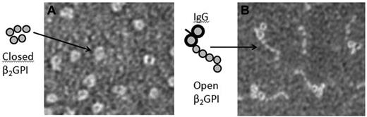 Figure 1. β2-glycoprotein I changes conformation on antibody binding. Scanning electron microscopy images showing plasma β2-GPI (A) and β2-GPI in complex with antibodies against domain I of β2-GGI (B). Samples were visualized using a Jeol JEM 1230 transmission electron microscope operated at 60 kV accelerating voltage and recorded with a Gatan Multiscan 791 CCD camera using the software provided by the manufacturer (magnification 200 000×).