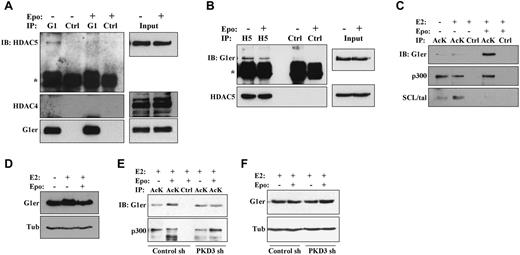 Figure 4. Erythropoietin promotes dissociation of GATA1-HDAC5 complexes and acetylation of GATA1. (A) Analysis of GATA1 interaction with HDAC5 by GATA1 immunoprecipitation (IP). Extracts from G1ER cells ± erythropoietin (Epo) stimulation underwent IP with anti-GATA1 (G1) or control (Ctrl) antibodies followed by immunoblotting (IB) for HDAC5, HDAC4, and GATA1. “G1er” refers to the position of the GATA1-ER fusion. *Immunoglobulin heavy chain. See also supplemental Figure 4A. (B) Analysis of HDAC5 interaction with GATA1 by HDAC5 immunoprecipitation (IP). Extracts from G1ER cells expressing human HDAC5 ± Epo treatment underwent IP with anti–human-HDAC5 (H5) or control (Ctrl) antibodies followed by immunoblotting (IB) for GATA1 and HDAC5. “G1er” refers to the position of the GATA1-ER fusion. *Immunoglobulin heavy chain. (C-D) Analysis of GATA1 acetylation. (C) Extracts from G1ER cells ± erythropoietin stimulation underwent immunoprecipitation (IP) with anti–acetyl-lysine (AcK) or control (Ctrl) antibodies followed by immunoblotting. (D) Input levels of GATA1. (E-F) Contribution of PKD3 to erythropoietin–induced GATA1 acetylation. G1ER cells transduced with the sh 186 (PKD3 sh) and sh 187 (Control sh) constructs (see Figure 1B) were analyzed for GATA1 acetylation as in panels B and C. See also supplemental Figure 4.
