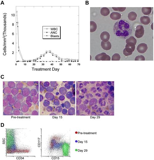 Figure 1. In vivo terminal myeloid differentiation in patients treated with quizartinib. (A) Graph of peripheral total WBC count, absolute neutrophil count (ANC), and absolute blast count in a representative patient (Table 1 patient 2) during the first 2 months of treatment with quizartinib. (B) Photomicrograph of a peripheral blood neutrophil from a whole blood sample collected from the patient shown in panel A on day 35 of treatment. (C) BM aspirates collected from a representative patient (Table 1 patient 7) 1 week before and on days 15 and 29 of treatment with quizartinib. (D) Flow cytometry analysis of BM aspirate specimens collected pretreatment and on days 15 and 29 from patient 7. The analysis was performed on the day of collection, and the dot plots are overlaid, organized by color.