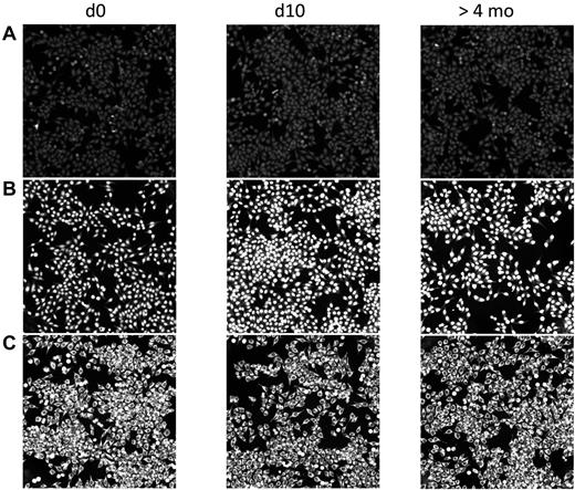 Figure 3. No change in autoreactive Abs in CPB patients after surgery. Human sera before (d0) and after CPB (d10 and > 4 months) were diluted in 20% FCS/PBS and incubated on commercially available HEp2-ANA slides. Bound Abs were visualized with FITC-conjugated anti–human IgG. The staining did not reveal any increase of autoreactive Abs postoperatively. Patient A is representative of the majority of patients (124 of 166) who showed no autoreactive Abs at any time. The 2 patients shown in panels B and C already had Abs against nuclear or cytoplasmic Ags before surgery. These did not change in quality or quantity after surgery. Twenty of the 166 patients had similar findings.