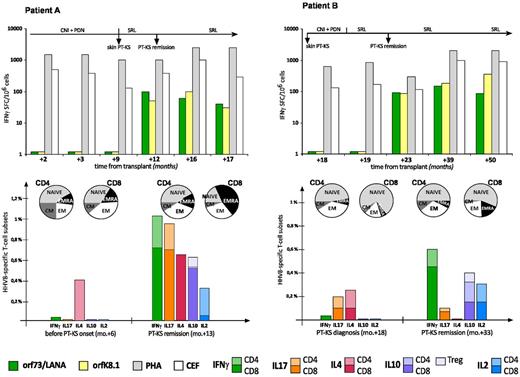 Figure 3. HHV8-specific T-cell profiling in 2 PT-KS patients who achieved remission after switch to sirolimus. IFNγ-enzyme–linked immunosorbent spot assay (IFNγ-ELISPOT; top panels) and cytokine secretion assay (CSA; bottom panels) were used to perform HHV8-specific immunologic monitoring in 2 renal recipients (patient A, left panels; patient B, right panels), who developed skin PT-KS after 9 and 18 months from transplantation, respectively. Both lytic (orfK8.1) and latent (orf73/LANA) HHV8-derived antigens were used as specific T-cell stimulations in both assays. After switching from tacrolimus- to sirolimus-based immunosuppressive regimens, both patients rapidly achieved complete PT-KS regressions and concurrently showed the recovery of HHV8-specific cytotoxic T cells. Such responses, which were absent at PT-KS diagnosis, were readily detectable during all post-remission follow-up, as demonstrated by IFNγ-ELISPOT long-term immunologic monitoring. Furthermore, in both cases, we applied CSA assays to perform a phenotypic and functional characterization of HHV8-specific T cells, either at the time of PT-KS onset (or before, in patient A) or after remission. Here we have also shown that frequencies of different HHV8-specific T-cell subsets, as defined by surface markers (CD4+ and CD8+) and cytokine productions (IFNγ, IL-17, IL-4, IL-10, and IL-2), may also well correlate with the disease course, possibly revealing a “nonprotective” Th2 prevalence at time of PT-KS diagnosis and a “protective” Th1 prevalence after remission. HHV8-specific T-cell subsets are expressed as percentages of total CD4+ or total CD8+ T cells. Nonspecific memory T-cell profiling data are also reported over the related CSA assays. PDN indicates prednisone; SRL, sirolimus; IFNγ-SFCs, interferon-γ–producing spot-forming cells; PHA, phytohemagglutinin; CEF, CMV, EBV, influenza virus-derived antigens; CM, central memory; EM, effector memory; and EMRA, CD45RA+ effector memory.
