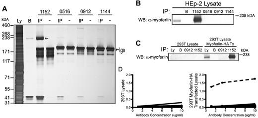 Figure 3. Identification of myoferlin as a uniquely recognized self-antigen. (A) Silver stain of a 3%-8% Tris-acetate gel of proteins immunoprecipitated (IP) from HEp-2 cell lysate by the indicated recombinant tumor Igs. (−) indicates lanes containing tumor Ig proteins only; IP, lanes containing the immunoprecipitated proteins; Ly, lysate; and B, lysate IP with protein G beads only. The left arrow indicates the 236-kDa protein immunoprecipitated by the tumor Ig of patient 1152; the right arrow points to the location of the tumor Igs. (B) Immunoblotting for myoferlin in immunoprecipitation samples from HEp-2 cell lysate. (C) Immunoblotting for myoferlin in immunoprecipitation samples from 293T cells transfected with recombinant myoferlin. (D) A total of 98 tumor Igs were tested for binding to recombinant myoferlin by ELISA. Myoferlin-HA was immobilized using anti-HA antibodies on lysates from untransfected (left panel) and transfected 293T cells (right panel). Shown is a representative graph of OD405-490 values for 14 different nonbinding patients' tumor Igs (solid lines) compared with tumor Ig for patient 1152 (dotted line). The ability of tumor Ig 1152 to bind myoferlin was confirmed in at least 2 independent experiments.