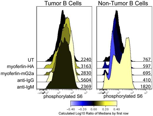 Figure 6. Myoferlin stimulates phosphorylation of S6 ribosomal protein in tumor cells. A single-cell suspension of the tumor biopsy was stimulated with 100 μL of detergent-adsorbed lysate of either untransfected 293T cells (UT), or 293T cells transfected to express recombinant myoferlin containing an HA tag or myoferlin fused to mouse IgG2a Fc. A total of 10 μg/mL of goat anti-IgG and IgM was used as positive control for BCR signaling for tumor and nontumor B cells, respectively. Cells were stimulated for 45 minutes at 37°C. Cells were then fixed with 1.6% paraformaldehyde and permeabilized with methanol. Cells were stained for expression of CD3, CD20, and phosphorylated S6 ribosomal proteins. Tumor and nontumor B cells were identified with CD3−CD20hi and CD3−CD20int gates, respectively. Values adjacent to histograms indicate median fluorescent intensities.