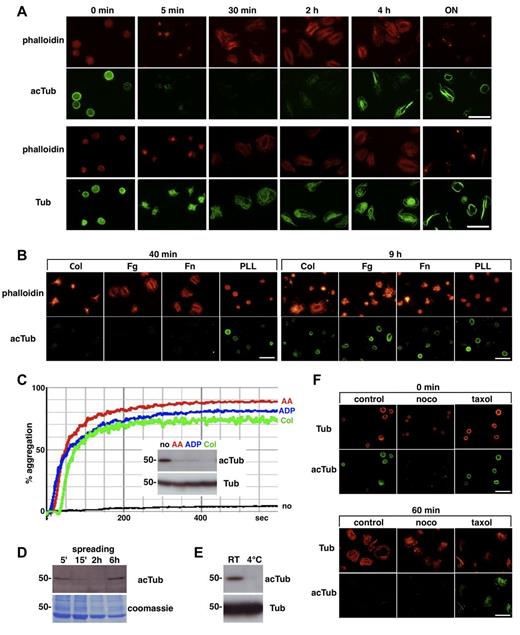 Figure 1. Dynamic changes of tubulin acetylation in activated platelets. (A) Human platelets were fixed after different spreading periods (as indicated, ON indicates overnight) on glass surfaces and stained using an antiacetylated tubulin antibody (clone 6-11B-1, Sigma-Aldrich, T6793; green, top panels) or an antitubulin antibody (clone B-5-1-2, Sigma-Aldrich, T5168; green, bottom panels) detected with AlexaFluor-488 goat anti–mouse IgGs (Invitrogen; A11029). Colabeling of the actin cytoskeleton with phalloidin-rhodamine (Sigma-Aldrich, P1951; red) served as an indicator for the extent of platelet spreading. Fluorescent images were acquired using an upright microscope (Olympus BX41) equipped with a color camera DP70 using a 100× oil immersion objective and the software analySIS. (B) Human platelets were incubated for 40 minutes (left panels) or 9 hours (right panels) on glass cover slips coated with 20 μg/mL collagen (Col), fibrinogen (Fg), fibronectin (Fn), or poly-L-lysine (PLL) and blocked with 3% BSA. Platelets were then fixed and stained using an antiacetylated tubulin antibody and phalloidin-rhodamine for the actin cytoskeleton. (C) Platelets in human PRP were induced or not (no) to aggregate with 1.5mM arachidonic acid (AA), 10μM adenosine diphosphate (ADP), or 10 μg/mL collagen (Col). Aggregation was followed using an APACT 4004/LABiTec aggregometer. The PRP was then centrifuged and the platelet pellet lysed and analyzed by Western blot using an acetylated tubulin and an antitubulin antibody (inset). (D) Human platelets were allowed to spread on glass Petri dishes (6 × 107/10 mL/dish) for the indicated periods of time and then scrapped and analyzed by Western blot using an acetylated tubulin antibody. The same membrane was stained with Coomassie as a loading control. (E) Human PRP was incubated for 20 minutes on ice or at room temperature and then centrifuged. The platelet pellet was lysed and analyzed by Western blot using an acetylated tubulin and an antitubulin antibody. (F) Human platelets were incubated for 30 minutes at room temperature with 15 μg/mL nocodazole, 25μM taxol, or without drug and then either fixed in suspension (top panel) or allowed to spread on glass coverslips for 60 minutes (bottom panel). Platelets were then stained with the mouse monoclonal antiacetylated tubulin antibody and a monoclonal rabbit antitubulin antibody (clone EP1332Y, Millipore, 04-1117) detected with AlexaFluor-546 goat antirabbit IgGs (Invitrogen; A11035) as indicated. Scale bars represent 10 μm.