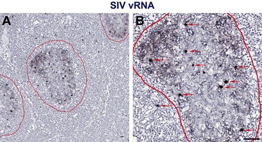 Figure 2. In situ hybridization vRNA patterns in secondary lymphoid tissues in chronically SIV-infected RMs. In situ hybridization signal at (A) low magnification and (B) high magnification within the secondary lymphoid tissue shows 2 distinct and distinguishable patterns: (1) FDC-trapped virions showing a typical “lattice-like” diffuse vRNA pattern, and (2) productively infected vRNA+ T cells showing a strong intense spherical staining pattern. Follicles are outlined in red. Red arrows indicate productively infected SIV vRNA+ cells. Scale bars represent 50 μm.