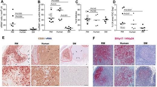 Figure 3. LN anatomic distribution of productively infected cells in RMs, humans, and SMs. (A) Quantitation of the number of SIV/HIV vRNA+ cells/mm2 in LNs of chronically infected RMs, humans, and SMs. (B) Frequency of SIV/HIV vRNA+ cells located within B-cell follicles in LNs of chronically infected RMs, humans, and SMs. (C) The percentage of LN area that consists of B-cell follicles. (D) The percentage LN area of Gag+ (SIVp17+ or HIVp24+) FDCs in chronically infected RMs, humans, and SMs. (E) Combination SIV/HIV in situ hybridization and CD20 IHC showing the relative frequency of SIV/HIV vRNA+ cells located within B-cell follicles (arrowheads) and in the extrafollicular T-cell zone (arrows) in a representative RM, human, and SM at low magnification (top panels) and high magnification (bottom panel). Scale bars represent 50 μm. (F) SIVp17/HIVp24 Gag IHC showing the relative amount of FDC trapped SIV/HIV from 2 chronically infected RMs, humans and SMs. Note the dramatic variability in FDC trapping in SM compared with RM and human. Scale bars represent 50 μm. Horizontal lines represent the median. P values are based on the Mann-Whitney test.