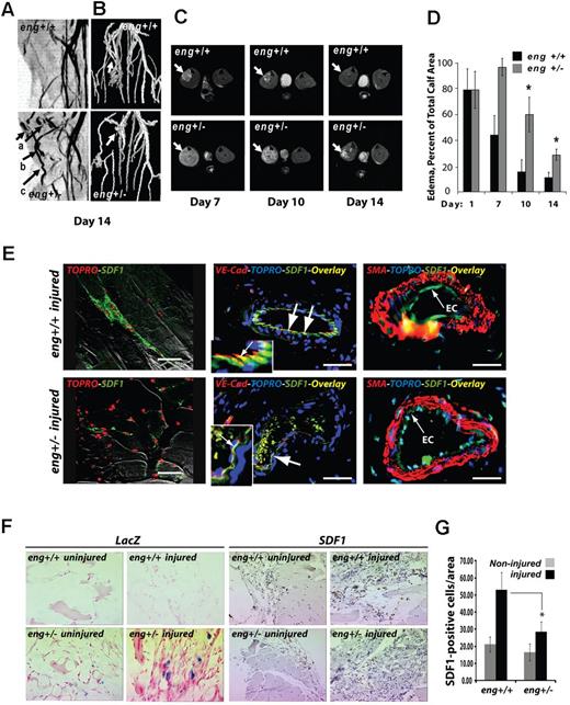 Figure 6. Eng+/− HHT-like vascular malformation and perfusion defects in hindlimb after ischemic injury. (A) MR multi-intensity plot reveals the presence of vascular malformations. Eng+/− vascular malformations not seen in wild-type eng+/+ vessels include (arrows): (a) focal dilatations; (b) dilated and thickened vessels; and (c) tortuous vessels. (B) MR surface projection shows collateral vessels formed in response to injury (arrows). (C) A representative axial view of 8-week-old eng+/+ and heterozygous endoglin-targeted (eng+/−) mice (n = 5/group) imaged using MR imaging (RARE8 images). Arrows indicate ischemic muscle with edematous water accumulation; brightness is proportional to degree of residual injury. (D) Percentage of muscle area with edema. *P < .05. n = 4 animals. (E) Anti–VE-cadherin and anti-SDF1 immunofluorescence show colocalization of SDF1 expression in endothelial cells (day 10 after injury; overlay color: yellow, arrows). Smooth muscle cell staining (red, SMA) highlights adjacent endothelial cell location of anti-SDF1 staining (green). SDF1 staining appeared less prominent in eng+/−–injured tissues. EC indicates endothelial cells. Nuclei were stained with TOPRO. (F) Mutant eng+/− and wild-type eng+/+ mice subjected to hindlimb ischemic injury; sections at day 10 were stained using anti-SDF1 antibody (or IgG-matched control) and visualized by horseradish peroxidase–conjugated secondary antibody. LacZ response is the result of the mutated eng allele,52 which is absent in wild-type sections. Strongest SDF1 response is in injured eng+/+ tissues (arrows). (G) SDF1-positive stained cell counts/field for noninjured and injured eng+/+ and eng+/− hindlimb ischemia tissue sections measured as previously described.35 *P < .05. n = 3 fields counted/section.