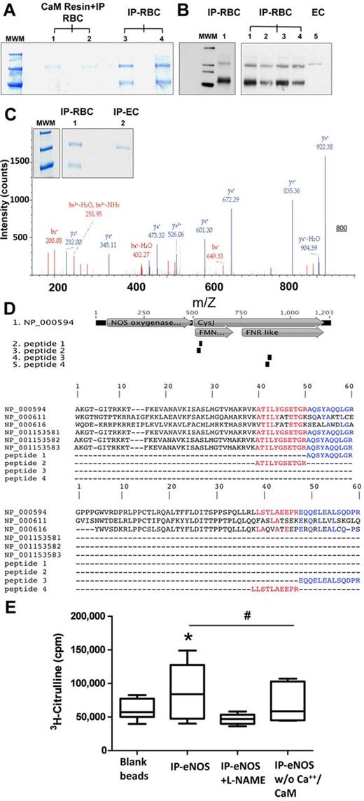 Figure 4. Human RBCs contain an active NOS3. (A) Constitutive NOS (135 kDa) was isolated from human RBCs by affinity chromatography with a calmodulin (CaM)–binding column followed by immunoprecipitation (IP) with a mouse anti–human NOS3 or directly by immunoprecipitation from crude RBC lysates (lanes 1 and 2, as well as 3 and 4 are independent samples). (B) The NOS enzyme was isolated directly from crude red cell lysates by immunoprecipitation with a mouse anti–human eNOS antibody and analyzed by Western blotting. As a control a crude EC lysate was loaded in lane 5 (MWM indicates molecular weight marker). (C) Coomassie gel used for identification purposes and representative example of peptide identification by LC-MS/MS sequencing; depicted is the fragmentation spectrum of the peptide AQSYAQQLGR. (D) Alignment of peptides identified by LC-MS/MS with sequences of nNOS, iNOS and all known eNOS splice variants. Top panel: Peptides 1 and 2 aligned within the FMN reductase-like region (FMN binding region), whereas peptides 3 and 4 aligned with the ferredoxin reductase (FNR)–like region (FAD and NADPH binding region). CysJ indicates sulfite reductase, α subunit (flavoprotein) region. NOS oxygenase indicates nitric oxide synthase eukaryotic oxygenase domain. Bottom panels: The sequences shown in detail and compared with the other NOS isoforms. The sequences of the peptides are identical with NOS3, isoform 1 only. NP_000611 = NOS1, nNOS, NP000616 = NOS2, iNOS, NP_000594 = NOS3, isoform 1. Splice variants of NOS3 are NP_001153581 = NOS3, isoform 2, NP_001153582 = NOS3, isoform 3, NP_001153583 = NOS3, isoform 4. (E) Activity of immunoprecipitated red cell eNOS. The activity of NOS3 immunoprecipitated from RBCs was assessed by measuring the conversion of L-3H-arginine to L-3H-citrulline. Total radioactivity is expressed as counts per minute (cpm). (ANOVA P = .0447; Tukey IP versus IP+L-NAME *P < .05; #IP versus Ca2+/CaM t test P = .0394).