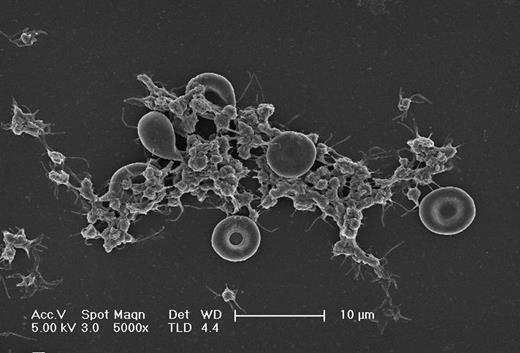 Fig 1b:. Scanning electron microscopy picture of erythrocyte-platelet interaction under flow