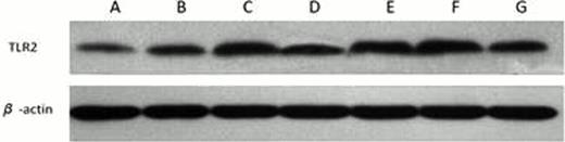 Figure 2. Different strains of GBS upgrated TLR2 expression in platelet. A)Plasma incubated with PBS as negative control. Plasma incubated with B) GBS 255, C) GBS 639, D) GBS 945, E) GBS 81875, F) GBS 90604, G) GBS 93555.