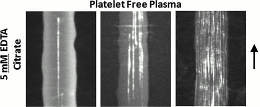 Figure 1. A, Platelet free citrated-plasma was treated with 1 μg/mL fluorescently labeled anti-vWF and 5 mM EDTA. The plasma samples were perfused over a collagen type 1 surface at local wall shear rates of 30,000, 62,400 and 125,000 s−1 from left to right. Long fibers of vWF (>20 μm) appeared at shear rates above ∼30,000 s−1, with more fibers appearing at higher shear rates. The bar indicates 15 μm.