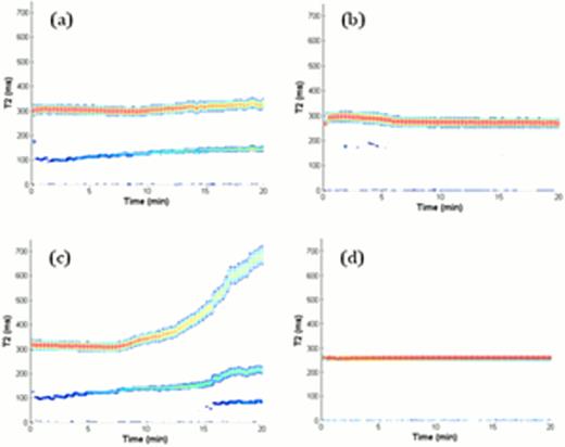 Figure 1. Examples of T2MR 3D surfaces for 34 μL of citrated whole blood mixed activated by adding a dried formulation of CaCl2 (11 mM) and kaolin (<0.25%) for (a) a normal platelet count (2.82×105 platelets/μL); (b) thrombocytopenia (9.0×104 platelets/μL); and (c) thrombocytosis (1.0×106 platelets/μL). All samples were reconstituted blood in the same way. (d) Citrated whole blood activated by ADP in the presence of 2-MeSAMP.