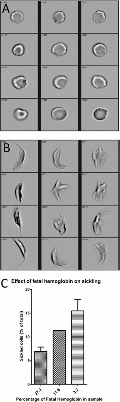 Figure 1. A, B: Random brightfield images of cells with shape ratios higher than 0.9 (A) and smaller than 0.2 (B) . / C: Effect of fetal hemoglobin percentage in sample on percentage of sickled cells. Results shown for shape ratio cut-off value of 0.5.