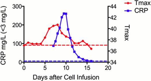 Figure. Maximum temperature in each 24-hour period (Tmax, red solid line) and CRP (blue solid line) correlate with cytokine release syndrome. Dotted lines indicate upper limits of normal. PB flow cytometry performed prior to cell infusion demonstrated 0.04% blasts and 1% normal B-cells. Repeat analysis after infusion revealed clearance of blasts, gradually decreasing B cells, and a maximum of 0.07% CD19CAR T cells (Days +3, +6, and +27). Re-staging evaluation on Day +27 revealed achievement of a complete remission with bone marrow (BM) blasts decreasing from 30% pre to 3% (flow cytometry 5% to 0.6%) and cerebrospinal fluid (CSF) blasts decreasing from 1.5% to 0%. 0.4% of BM T cells expressed the CD19CAR. (Table)