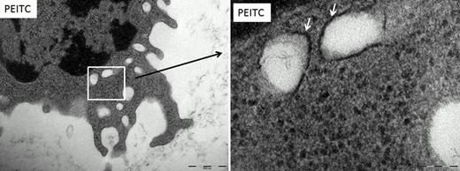 Figure 1. Transmission electron microscopy of CLL cells . / CLL cells were treated with 10μM PEITC. Double membrane bound organelles were found in the CLL cells after treatment which were not present in the no addition control (depicted by the arrows). These organelles are autophagsomes. Magnification (left picture) ruler is 500nM, (right picture) ruler is 100nM