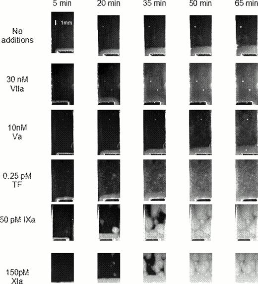 Fig. 2. Contibution of circulating active factors to the SC formation. . / Platelet-free plasma was supplemented with indicated coagulation factors, and the pattern of spatial clotting induced by immobilized TF was nalyzed. Images at different timepoints are shown.