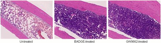 Figure 1. Histology of femurs from untreated bone marrow failure mice and PPAR-g antagonists treated mice. Both BADGE and GW9662 inhibited adipogenesis and increased cellularity in the bone marrow of AA mice.