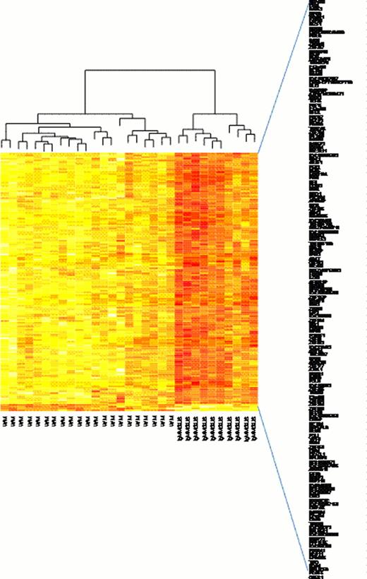 Fig. 1. GEP of BM WM CD19+ cells vs. IgMMGUS CD19+ cells.