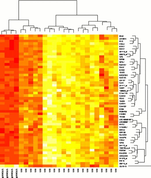 Fig. 2. GEP of BM WM CD138+ cells vs. IgMMGUS CD138+ cells.