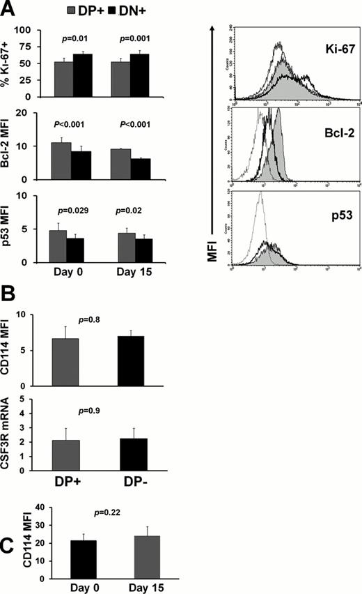 Figure 3. (A) Results and histograms of ki67, Bcl-2 and p53 assessment in DP (grey fill) and DN (thick line) subsets (control, thin line). (B) Protein and mRNA expression of CSF3R in patients with absence (n=5) or full expression (n=5) of the DP population. (C) Similar CSF3R levels at d0 and d15, despite changes in the levels of the DP subset (not shown, n=5).